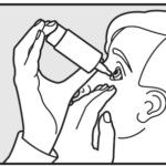 Hylo Gel 海露潤眼液用法: 5. 溫柔地拉開下眼簾,用力按壓樽身,避免管嘴直接接觸眼球